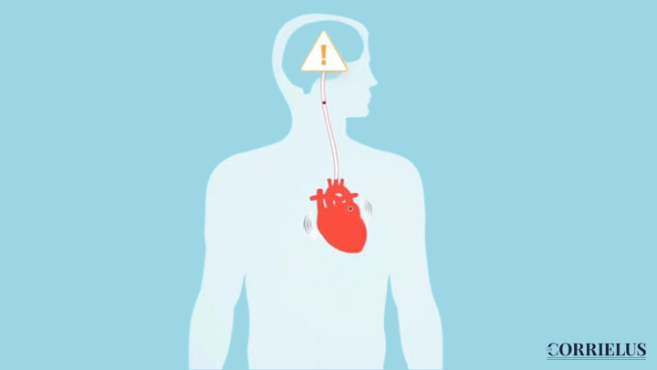 Atrial Fibrillation